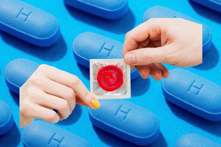 AIDS